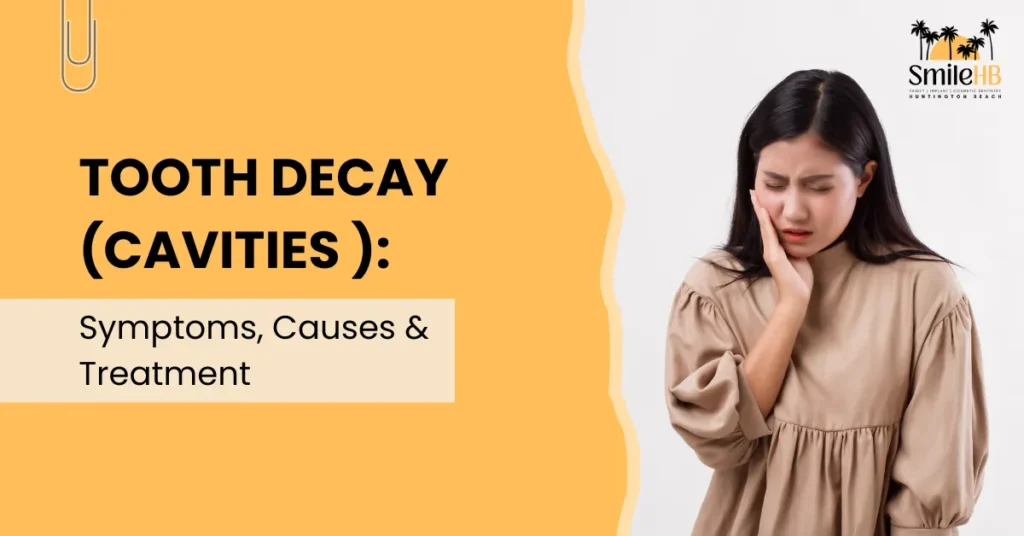 Tooth Decay (Cavities ) Symptoms, Causes & Treatment