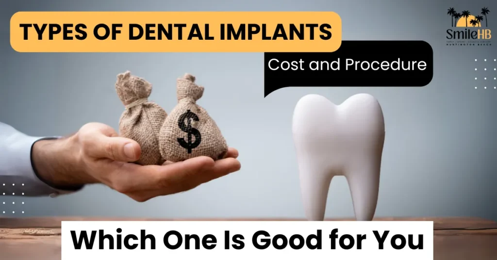 Types of Dental Implants: Cost, Procedure, and Best Choice for You