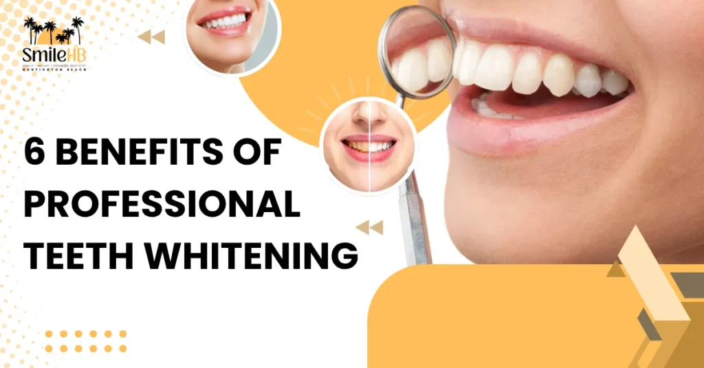 Teeth Whitening Benefits You Need to Know