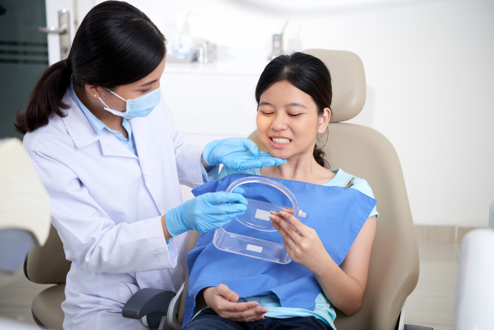 Ultra Veneers