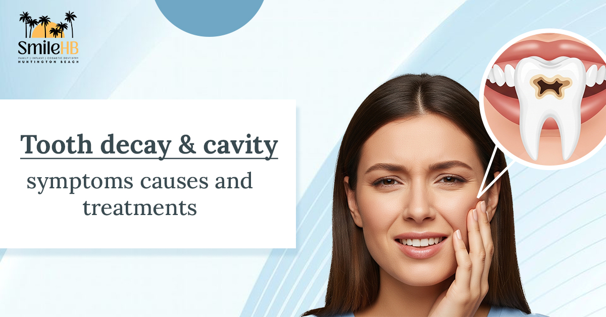 Tooth Decay & Cavity Symptoms, Causes, and Treatments - Dr. Noori